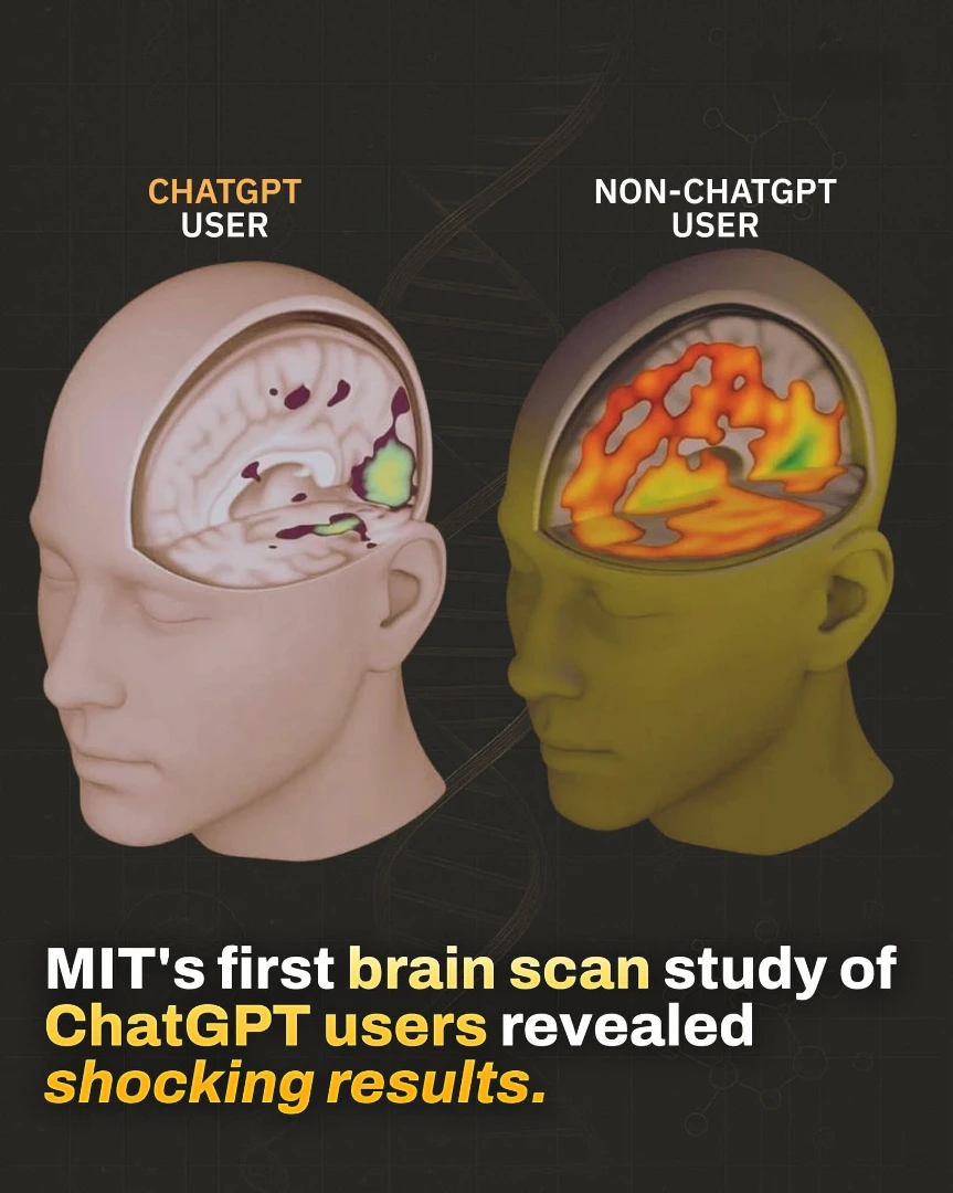 ఏఐ మన మెదడును నిద్రపుచ్చుతుందా? — ఎంఐటీ EEG అధ్యయనం & జింబాబ్వే కేస్ స్టడీ సారాంశం